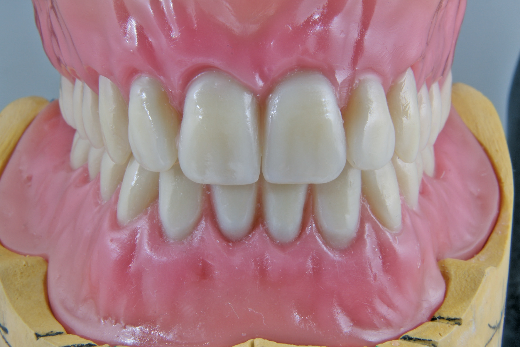 Abb. 9: Frontaufstellung und Gesamtüberblick.