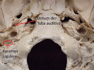 Abb. 9: Schädelbasis von kaudal mit Eingang in die knöcherne Tuba auditiva und Foramen jugulare (Exponat des Deutschen Medizinhistorischen Museums, Ingolstadt).