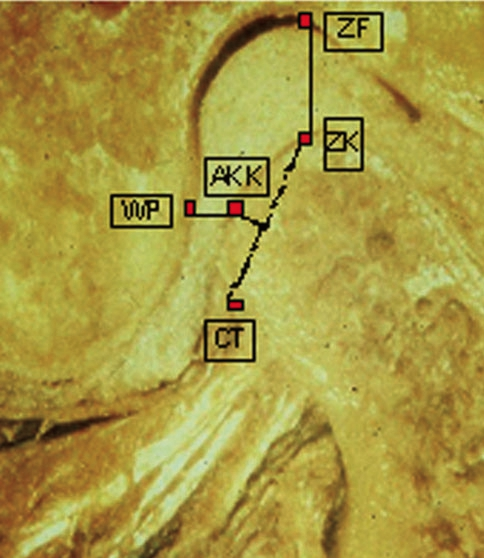 Abb. 9: MRT-Aufnahme; korrekte KTE-Stellung.