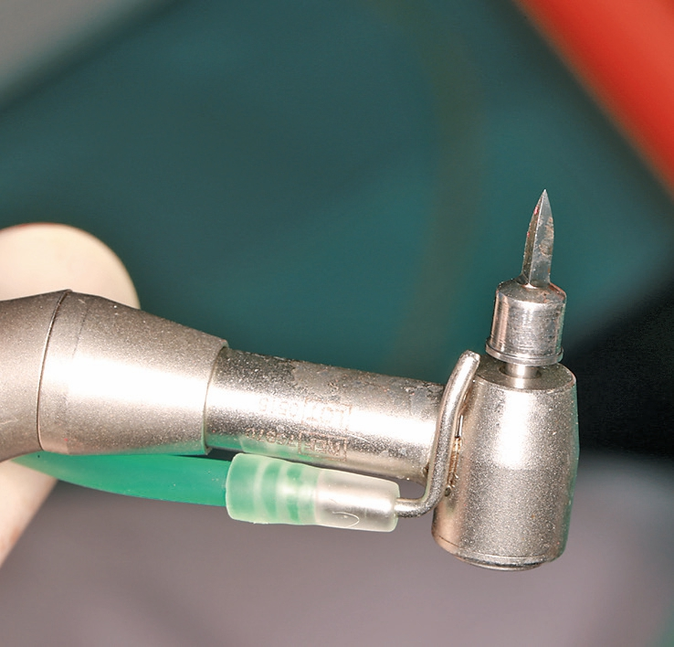 Abb. 10: Vorbohrer mit Tiefenstopp und Führung.