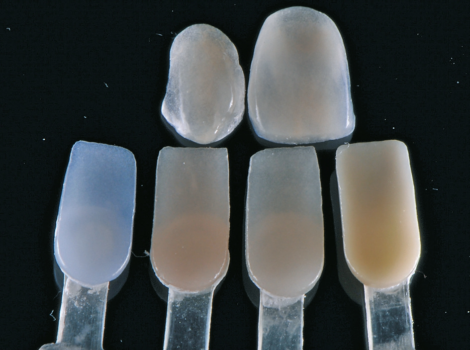 Abb. 10b: Die Veneers zeigen trotz geringer Substanz natürliche lichtoptische Eigenschaften.
