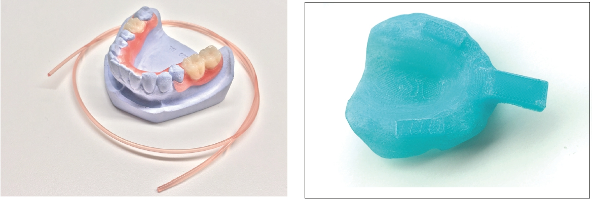 Abb. 10: Mittels Schmelzschichten aus Valplast-Filament gefertigt: links eine Klammerprothese, rechts ein individueller Abformlöffel.