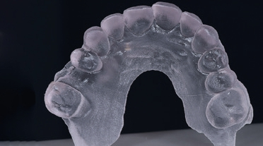Abb. 10: Kunststoffmodell des virtuellen Wax-up aus dem 3D-Drucker zur Herstellung eines Silikonschlüssels.