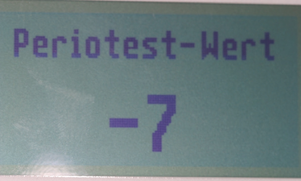 Abb. 10: Periotestwert von -7.
