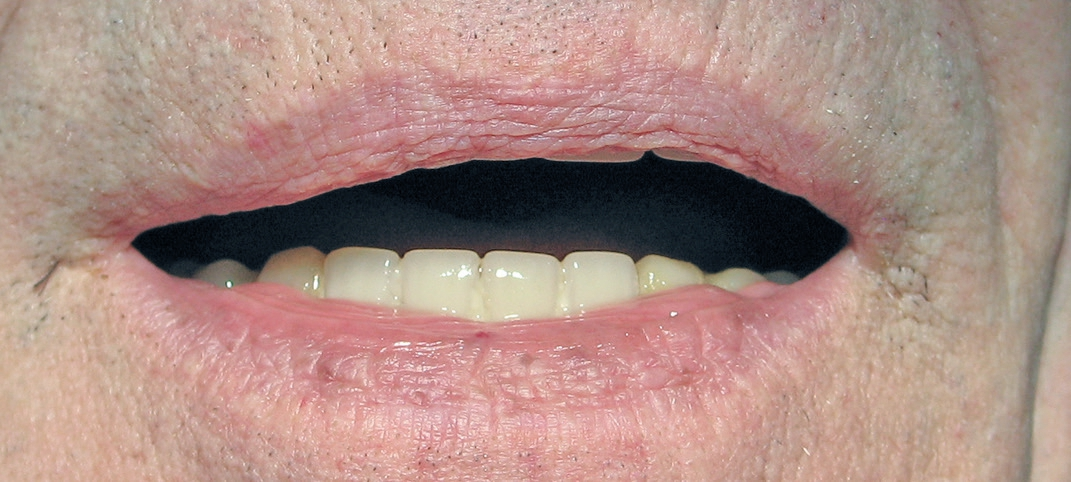 Abb. 9: Patientin frontal in der Ruheschwebelage.