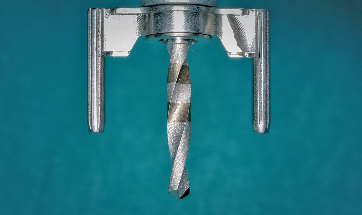 Abb. 10: Mit den insgesamt drei pilot.drills wurde das Knochenbett sukzessive aufbereitet.