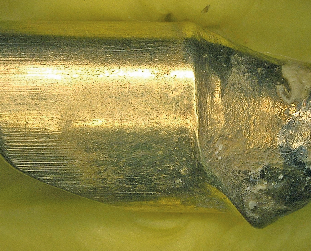 Abb. 8a: Region 15 – Abutment in 30-facher Vergrößerung: Man erkennt die Abriebspuren im Primärteil, obwohl das Sekundärteil aus weichem Galvanogold gefertigt ist. Siehe auch die korrespondierenden Galvanoflächen in Abb. 3.