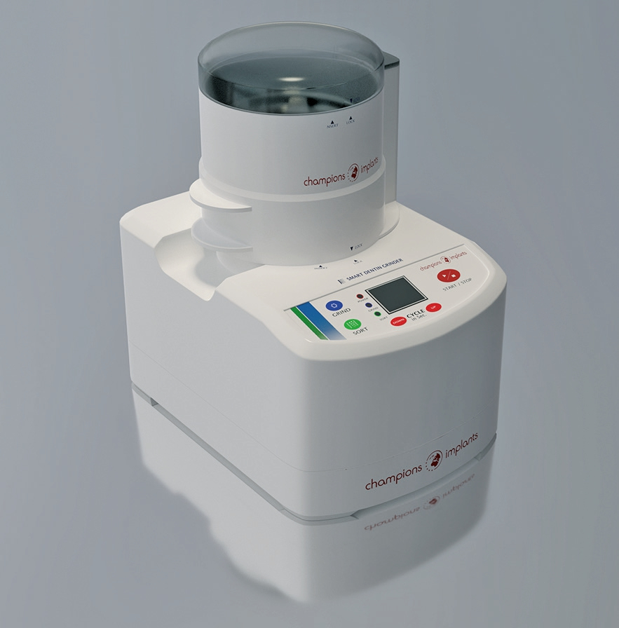 Abb. 12: Der Smart Grinder.