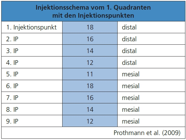Tab. 7: Die schematische Darstellung der intraligamentalen Injektionen im 1. Quadranten ist auch das Muster für die anderen Quadranten.
