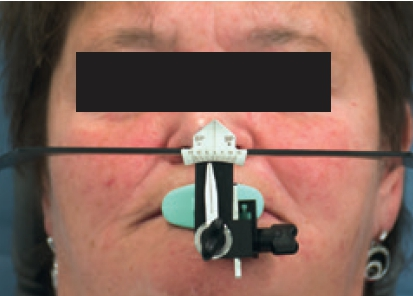 Abb. 10: Anpassung an die Bipupillarebene.