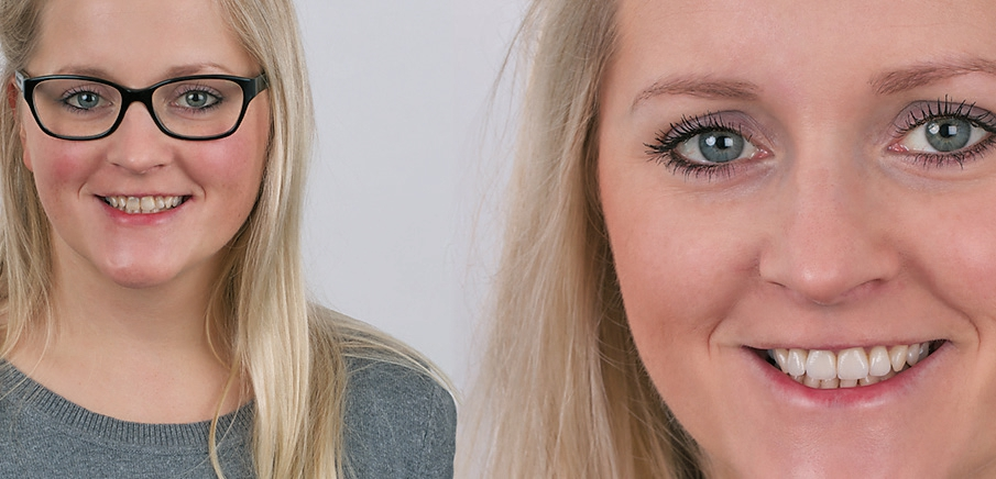 Abb. 11: Zufriedene Patientin im Vorher-Nachher-Bild.