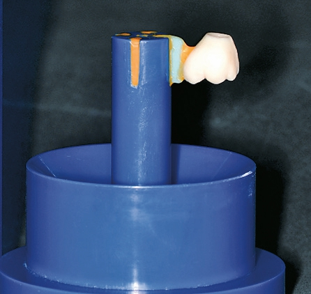 Abb. 11a: Überprüfen der Position der Krone auf der Muffelbasis mit dem IPS Multi Sprue Guide.