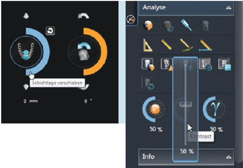Abb. 11a und b: Panorama-Editor bzw. Bildkorrektur – unterschiedliche Regler in Sidexis 4.