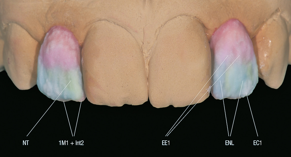 Abb. 11: Schichtung vor dem Korrekturbrand.