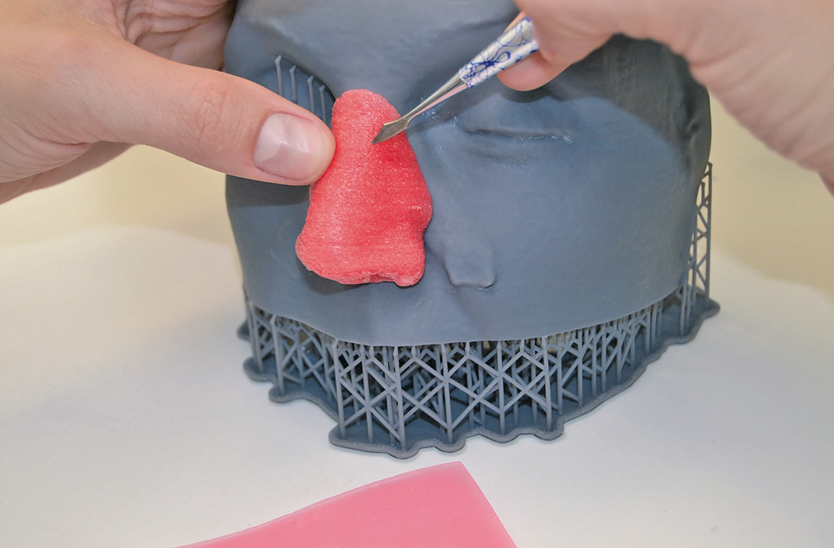 Abb. 10: Anprobe eines experimentellen Wachsprototyps am materialisierten Gesichtsscan einer Patientin mit Verlust der Nase.