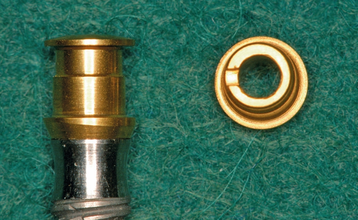 Abb. 12: Diskrepanzen zu dem benötigten Abstand von 18 mm zwischen den Implantaten können durch die dezentrischen „EBF (Eccentric Bar Fixation)“-Abutments kompensiert werden.