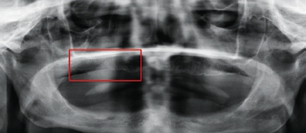 Abb. 18: PAN, ROI, OK.