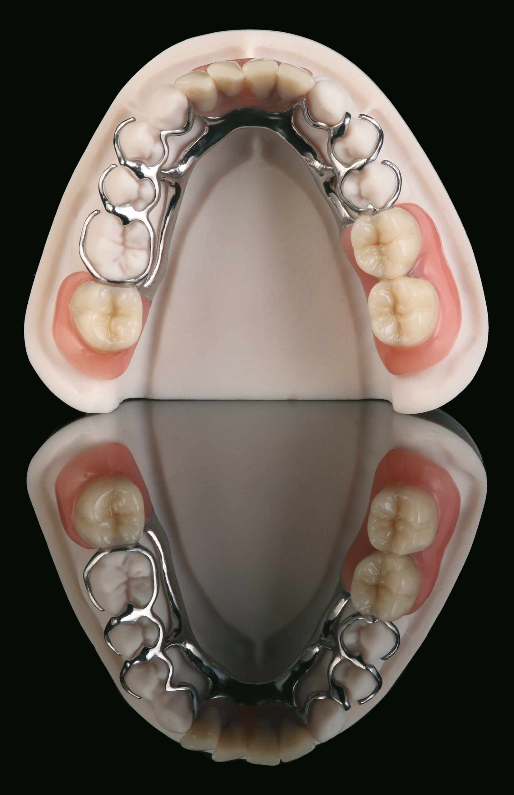Abb. 15: Fertige Klammermodellgussprothese: funktionell und schön.