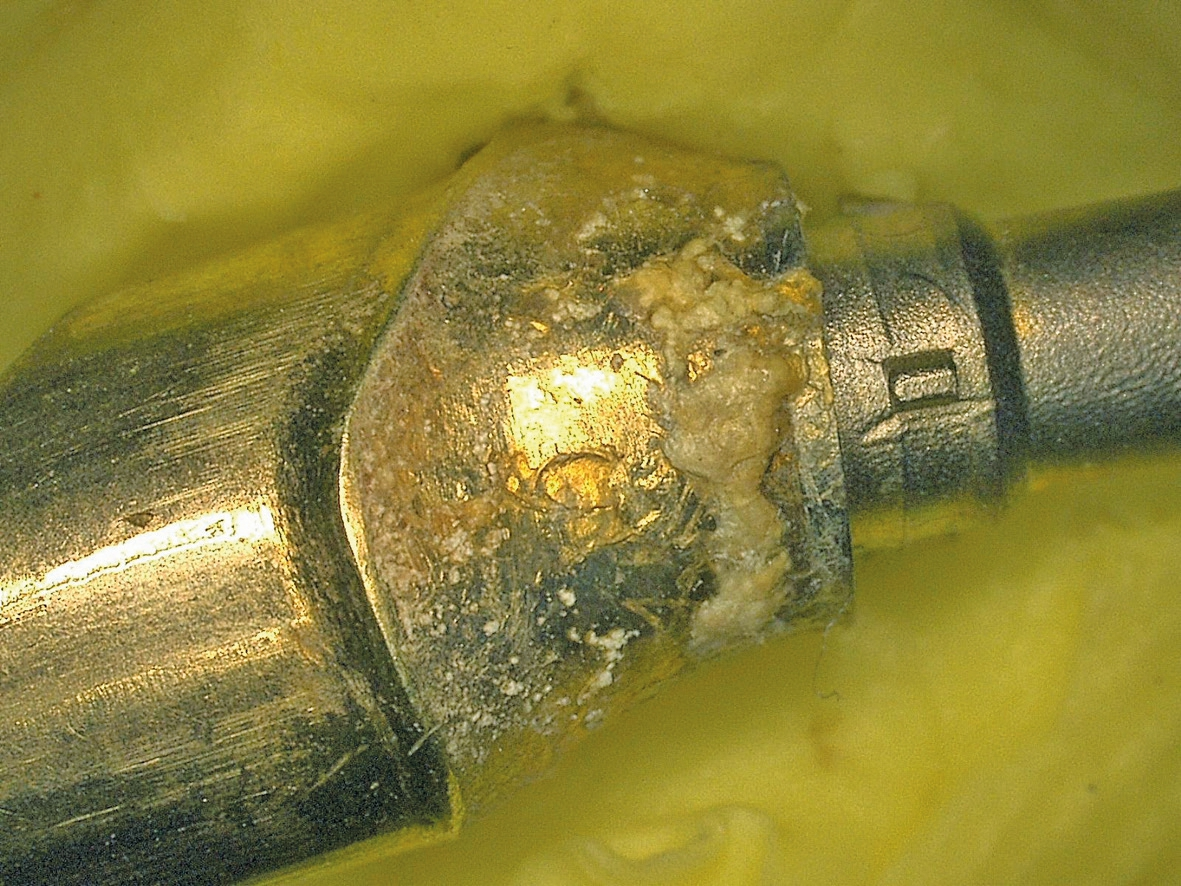 Abb. 9a: Region 16 – Abutment in 30-facher Vergrößerung: Man beachte die Plaqueablagerung – weder vom Patienten noch bei professioneller Zahnreinigung zu erreichen.