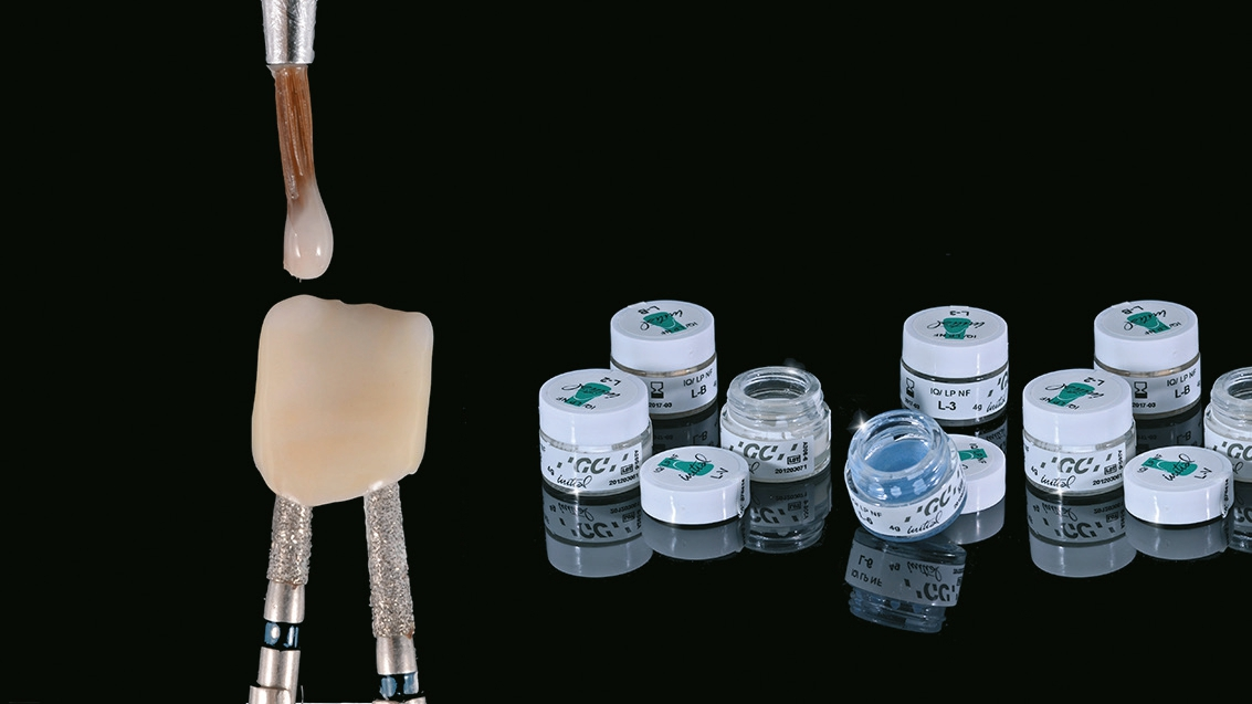 Abb. 12: Kolorierung und Einstellen der Farbe mit Lustre Pastes.