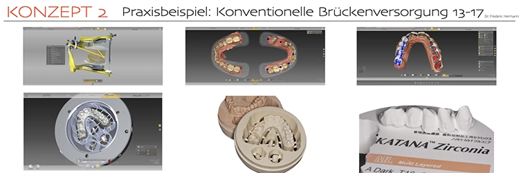 Abb. 2c: Design und Fertigung mit der inLAB-CAD/CAM Software.