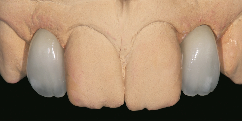 Abb. 13: Die fertige Arbeit auf dem Modell.