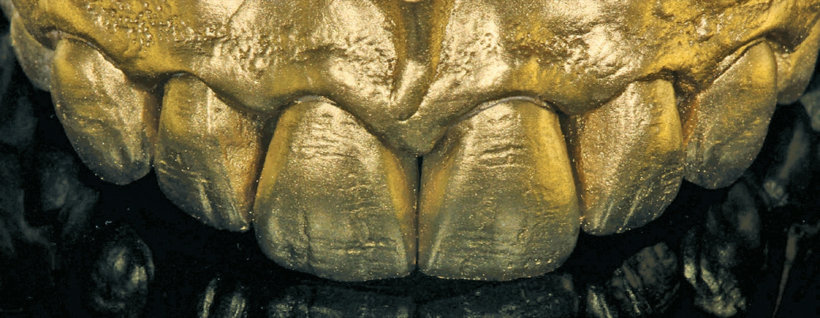 Abb. 12: Kontrolle der Konturen und Mikrotexturen mit Goldpulver.