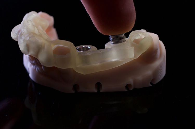 Abb. 13: Bohrschablone nach dem 3D-Druck.