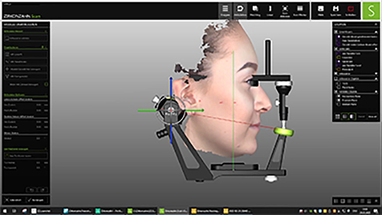 Abb. 4e: … Gesichtsscan …