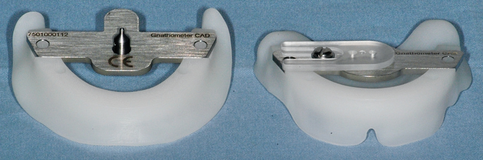 Abb. 14: 3D Bite Plates® mit eingeklicktem Gnathometer CAD®.