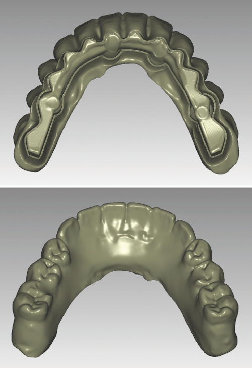 Abb. 20 u. 21: Generierte STL/Überwurf.