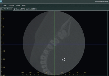 Abb. 14: Rotation des Bildes hinter den Achsen bei One Volume Viewer.