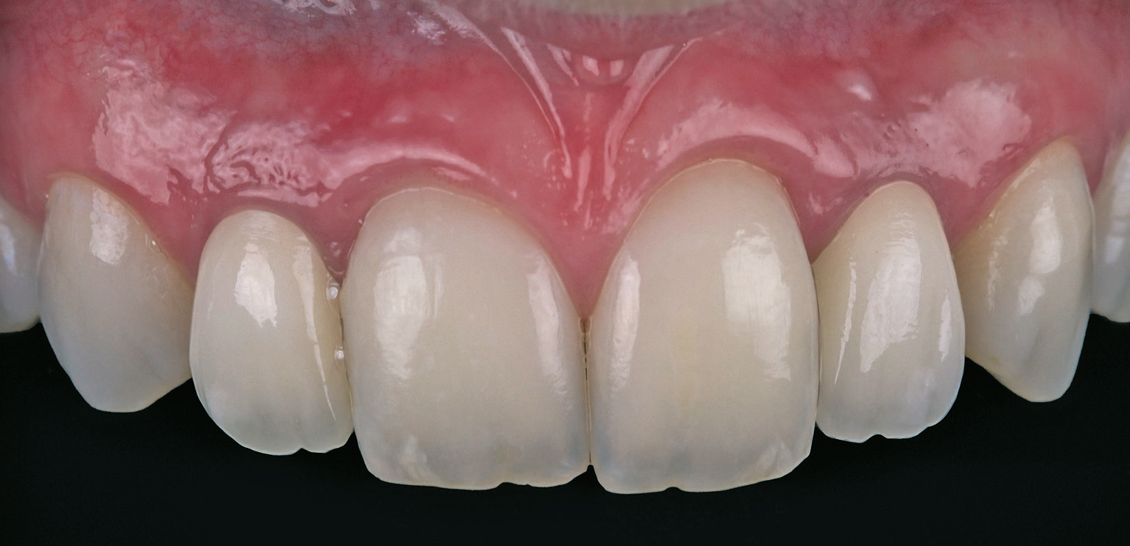 Abb. 14: Begutachtung im Mund.