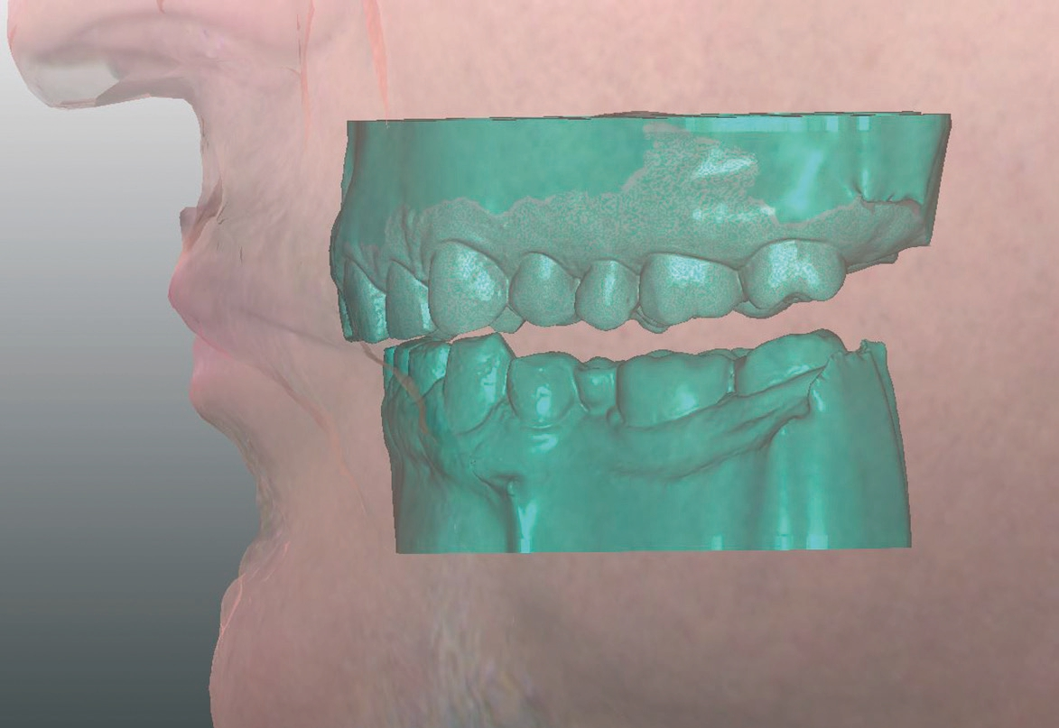 Abb. 9b: Über die fotorealistische Darstellung kann die Gesichtsphysiognomie bei der Konstruktion des Zahnersatzes einbezogen werden.