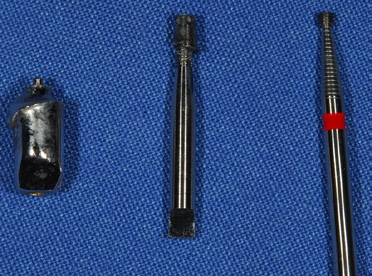 Abb. 19: Die Fragmente (v. l.): Abutment, Konus, Gewindekopf der Spannschraube.