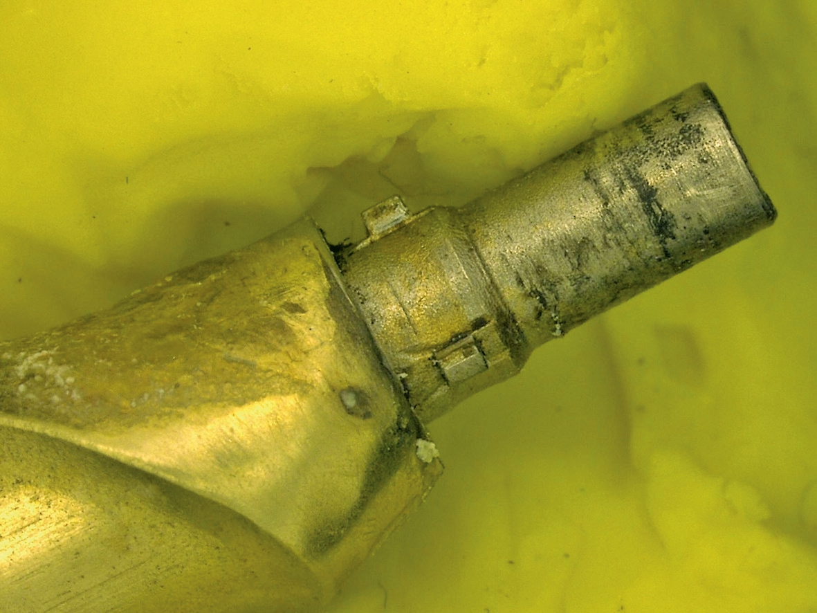 Abb. 10: Region 25 – Abutment in 30-facher Vergrößerung.