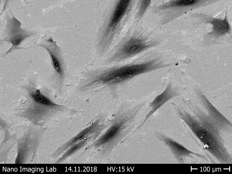 Abb. 14: Ausbreitung der Fibroblasten auf verschieden rauen Zirkonoxidoberflächen [43]. b: Polierte, hitzebehandelte Oberfläche.