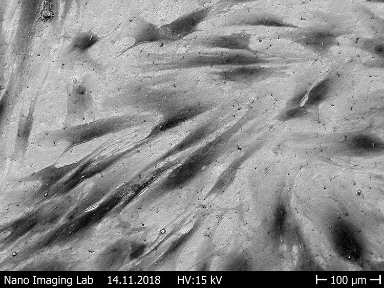 Abb. 14: Ausbreitung der Fibroblasten auf verschieden rauen Zirkonoxidoberflächen [43]. d: Gesinterte, hitzebehandelte Oberfläche.