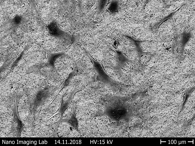 Abb. 14: Ausbreitung der Fibroblasten auf verschieden rauen Zirkonoxidoberflächen [43]. e: Raue Oberfläche.