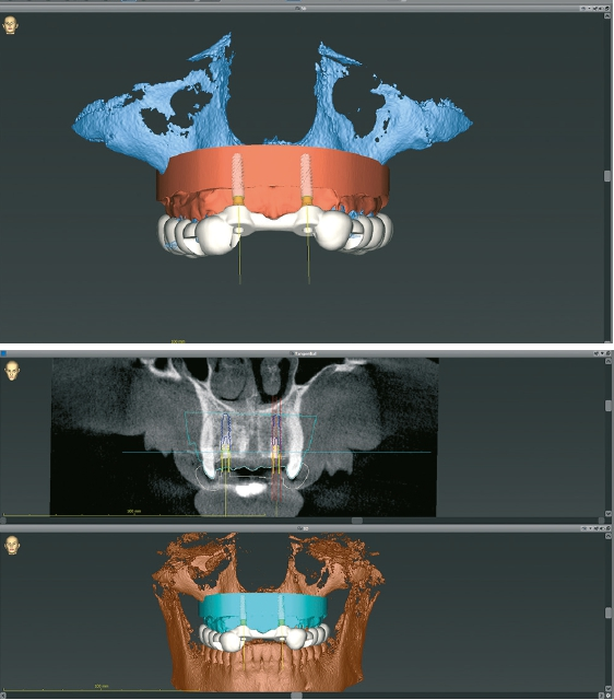 Abb. 16 u. 17: Blick in die Planungssoftware.