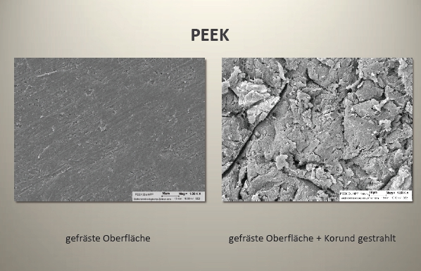 Abb. 15: REM-Aufnahme der gefrästen und Korund gestrahlten Oberfläche (jeweils mit 1.000-facher Vergrößerung aufgenommen).