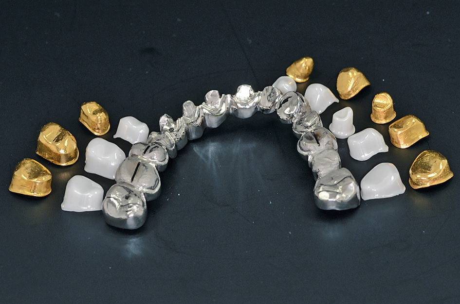 Abb. 15: Die heutige Dentalversorgung ist durch Materialvielfalt gekennzeichnet – hier ist das werkstoffkundliche Wissen des Zahntechnikers gefordert.