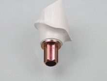 Abb. 21: Final bearbeitetes definitives BioHPP SKY elegance prefab Abutment.