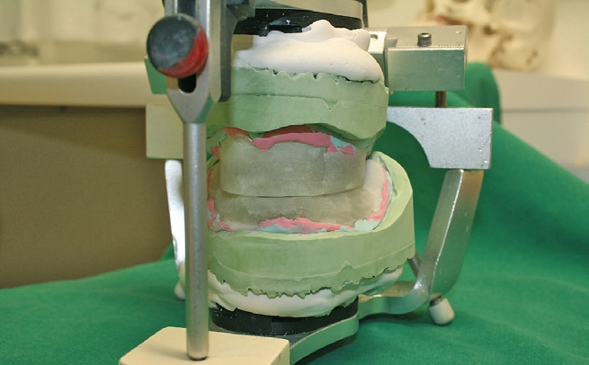 Abb. 11: Die Schablonen wurden anhand der Überprüfung in situ optimiert.