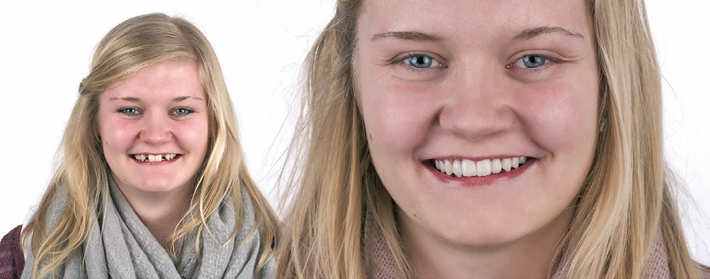 Abb. 17: Die Patientin vor und nach der Maßnahme.