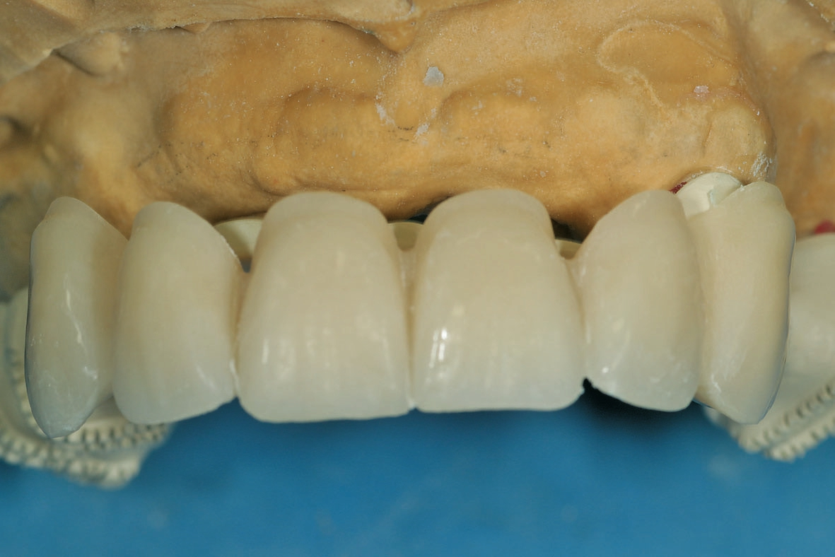 Abb. 19: Das OK-Gerüst von labial.