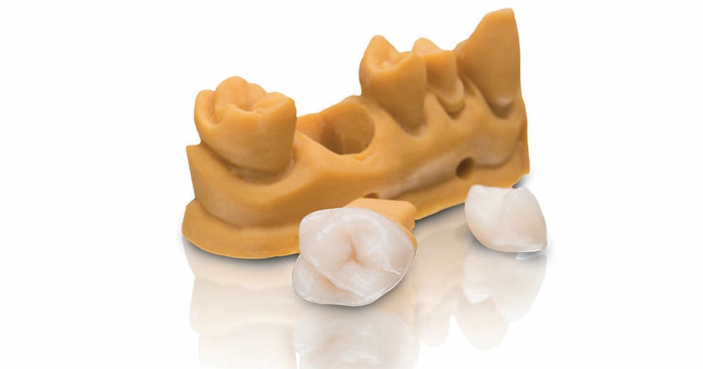 Abb. 20: Bego launchte VarseoSmile, ein Druckmaterial für permanente Einzelzahnrestaurationen.