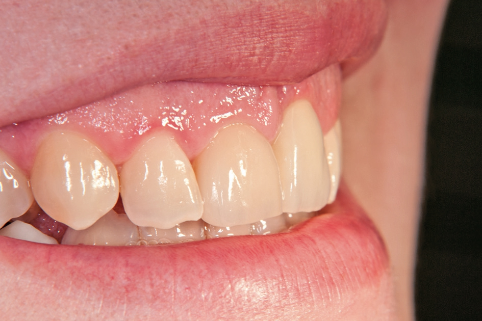 Abb. 18: Lippenbild.