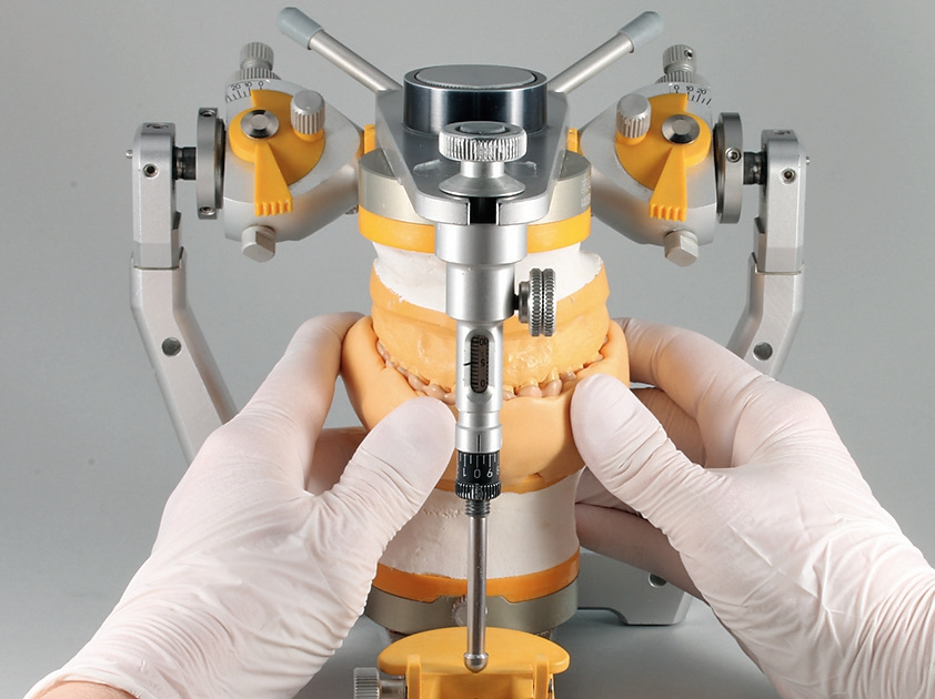 Abb. 31: Silikonummantelung des UK-Modells.