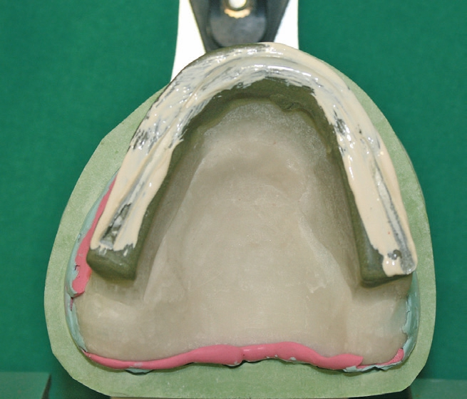 Abb. 13: Zentrikregistrat verfeinert.